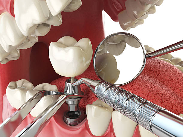 Dentist for Dental Trauma in NY